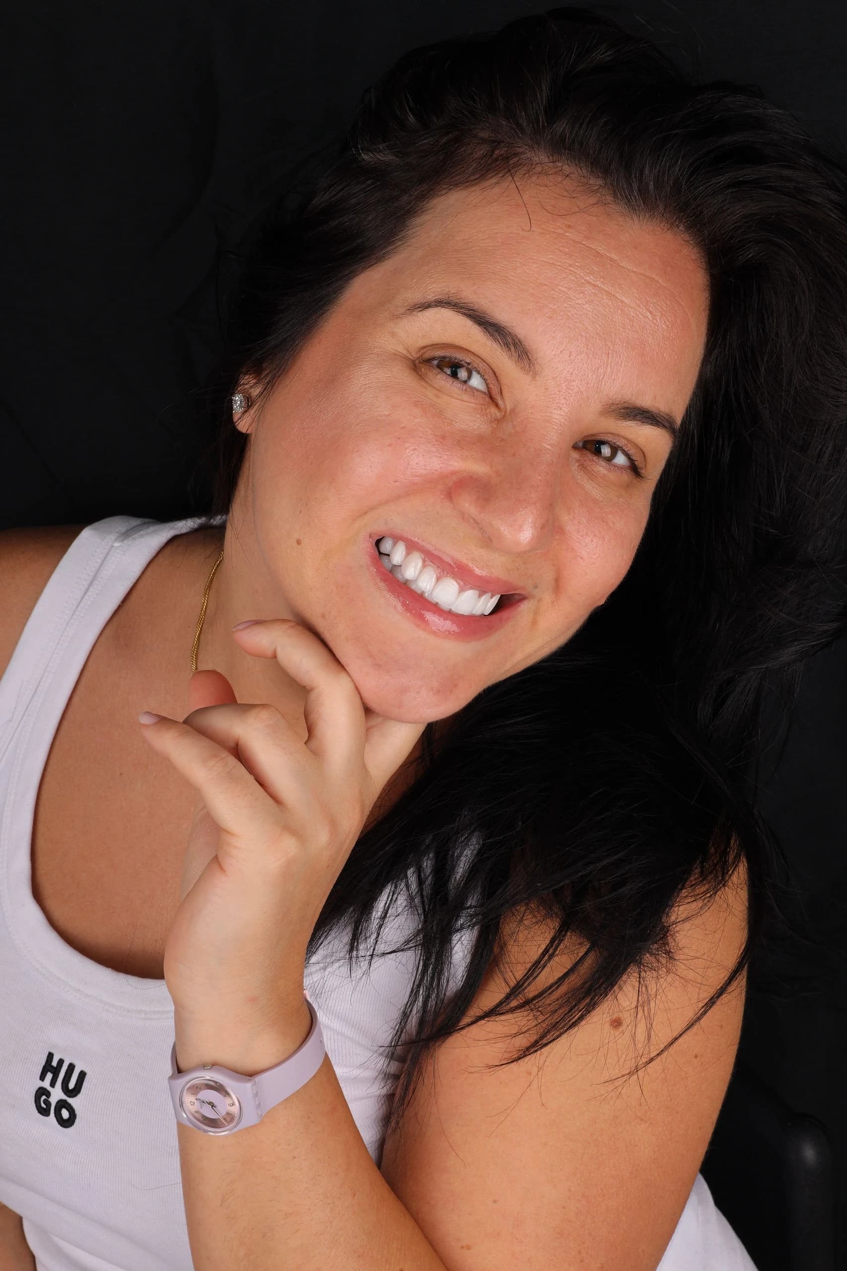Patient smile result 23