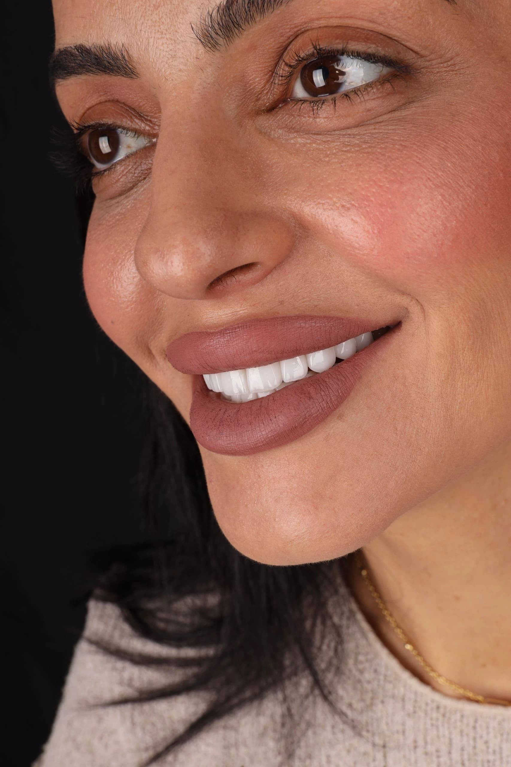 Patient smile result 21