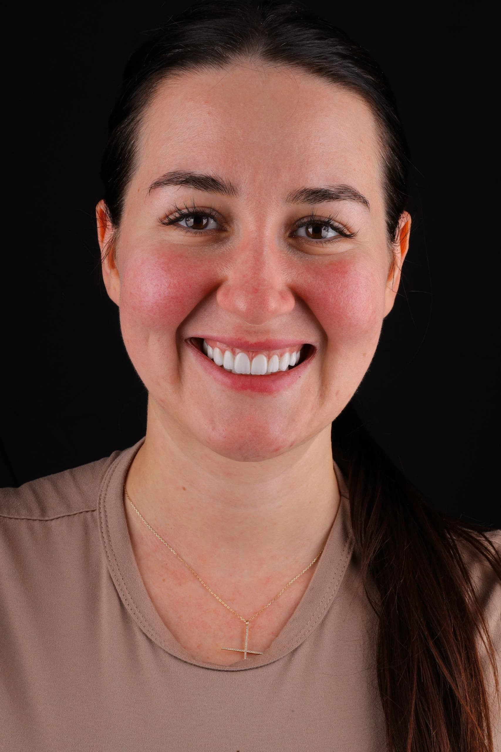 Smile Makeover