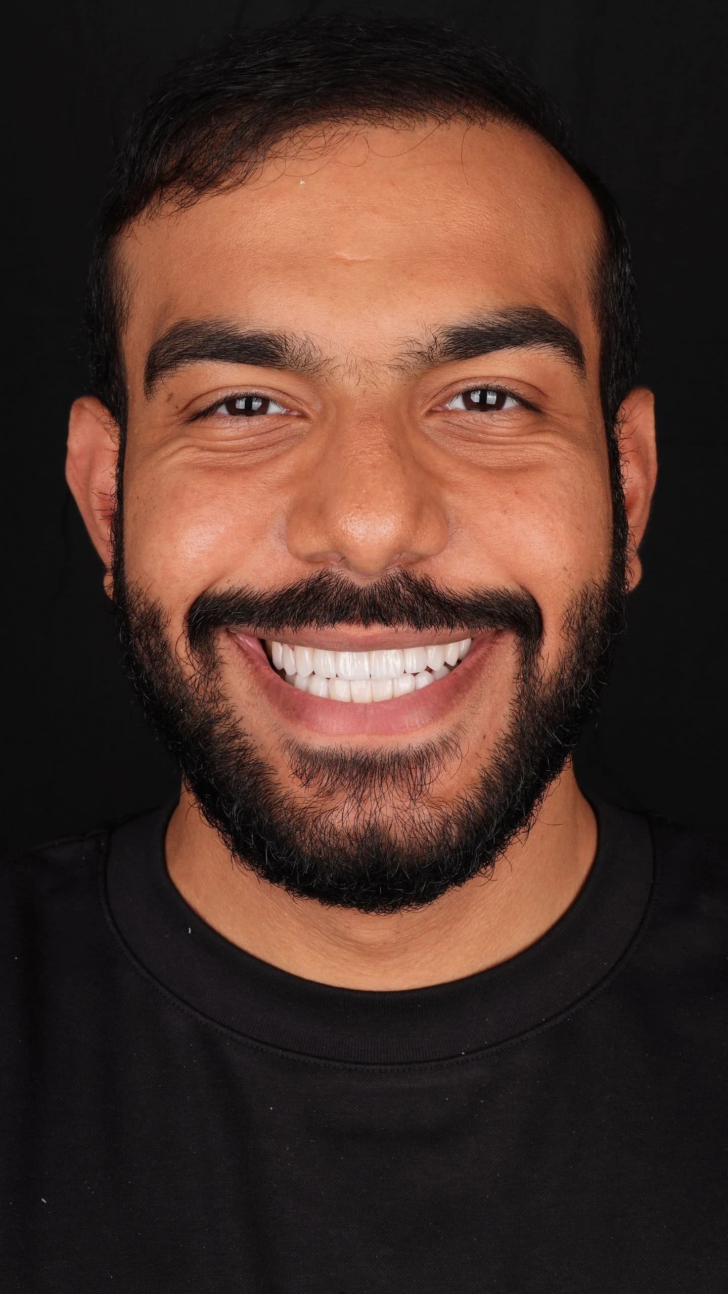 Patient smile result 18