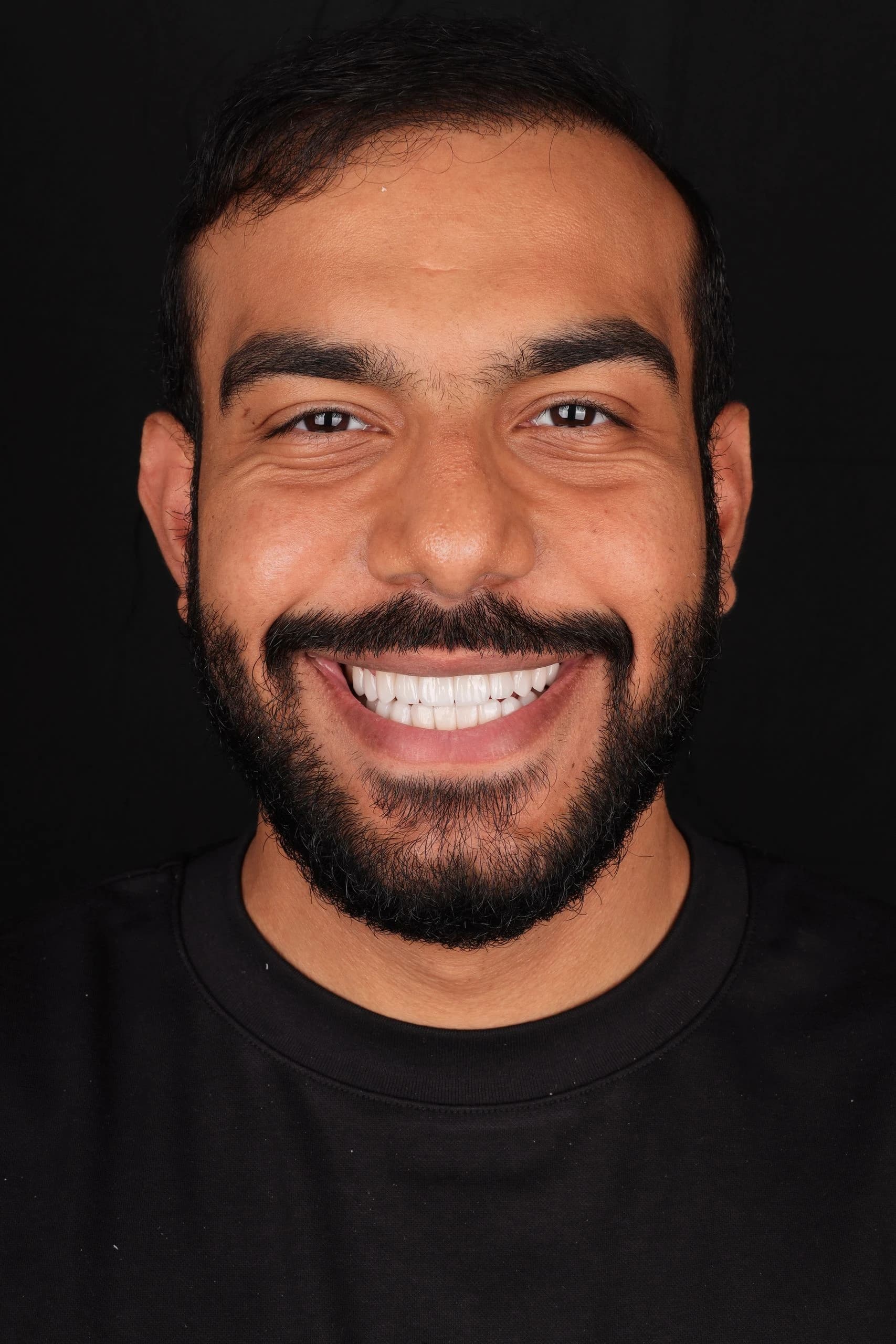 Patient smile result 13