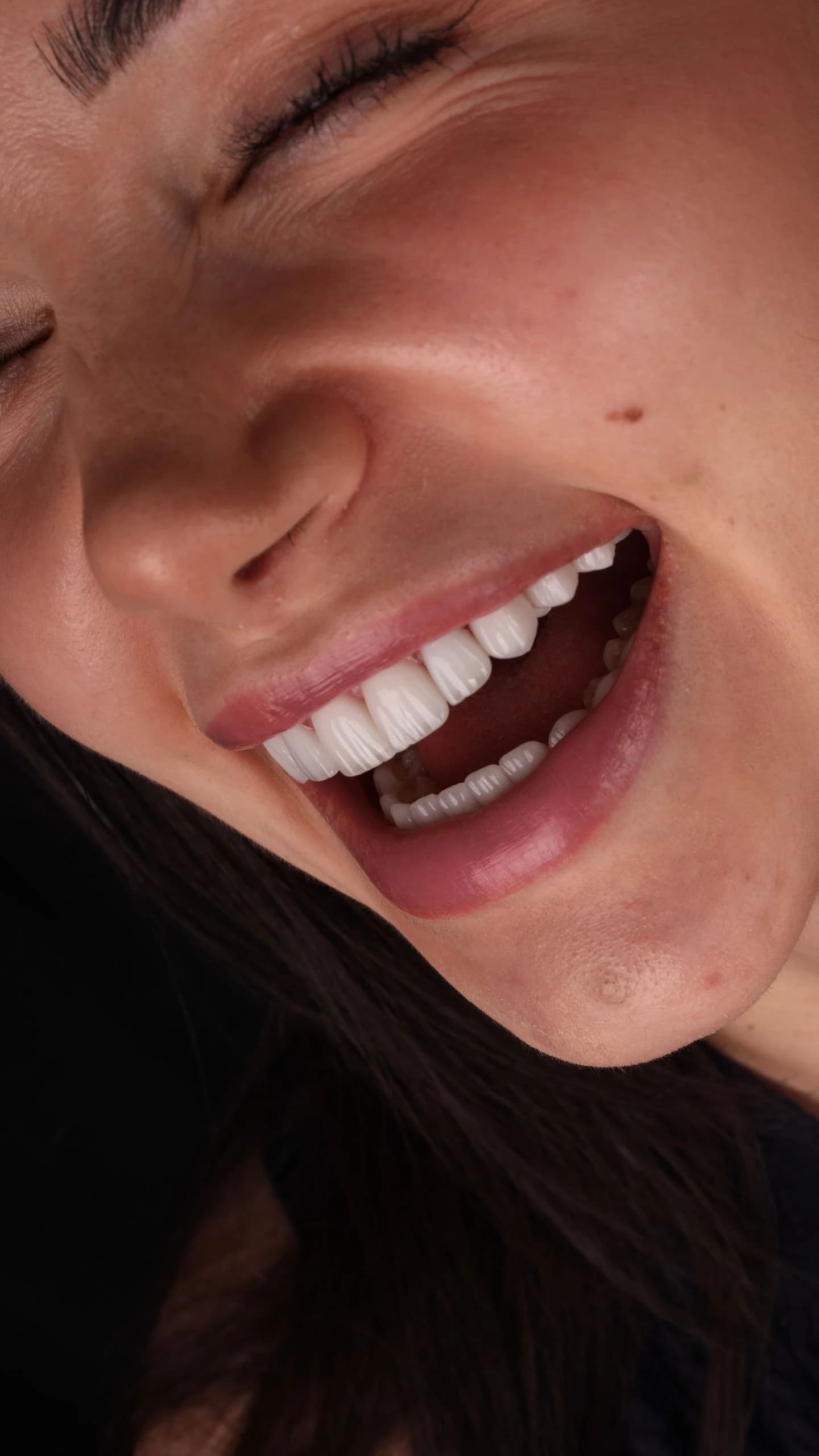 Patient smile result 12