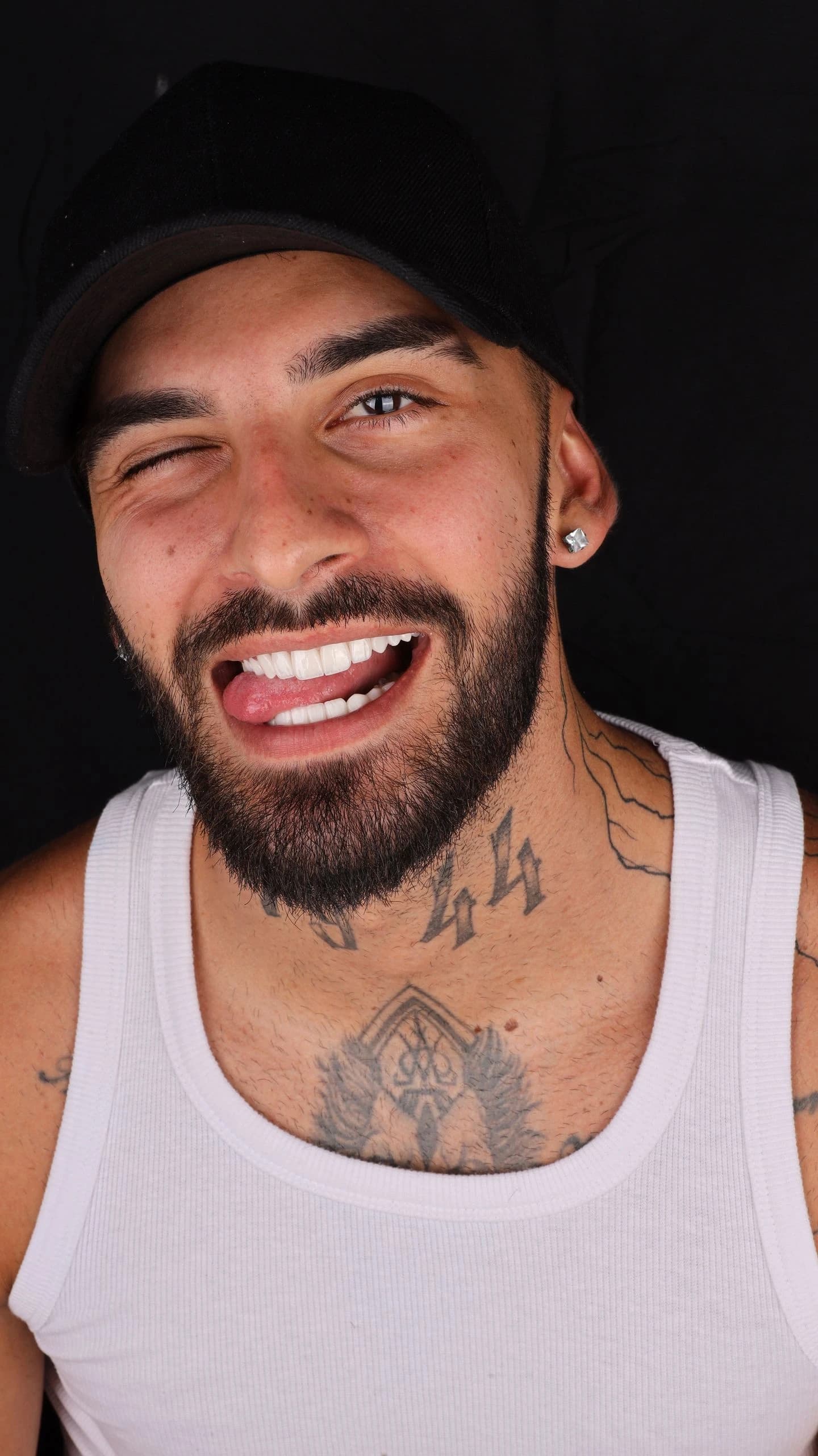 Patient smile result 21