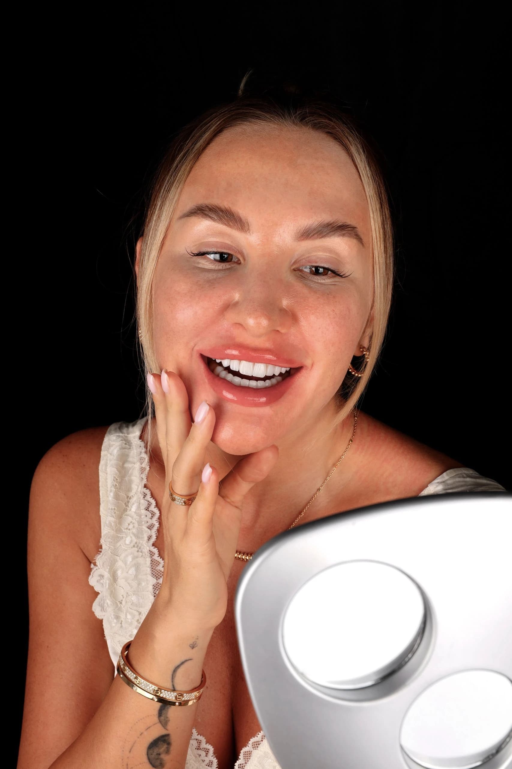 Patient smile result 10