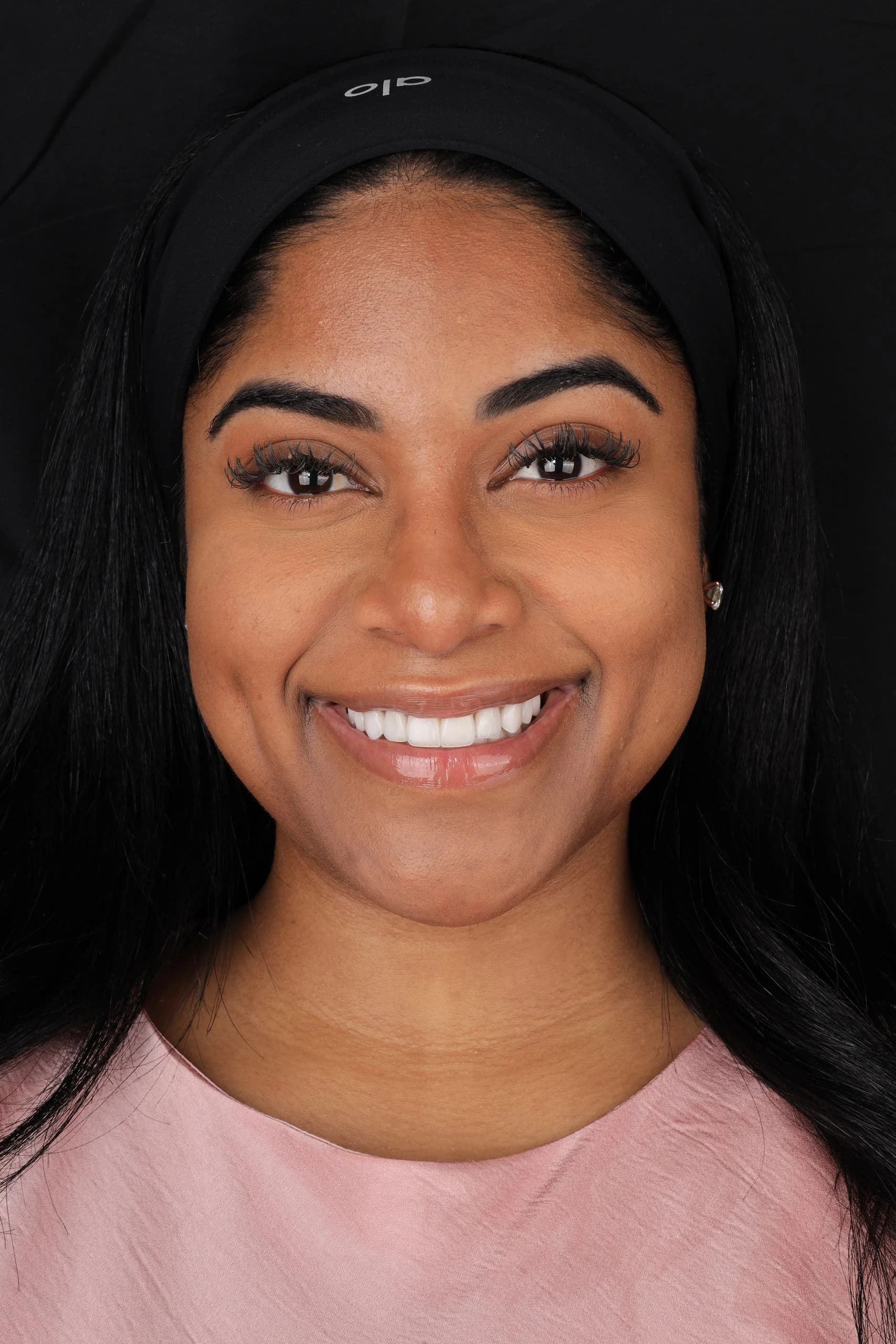 Patient smile result 9