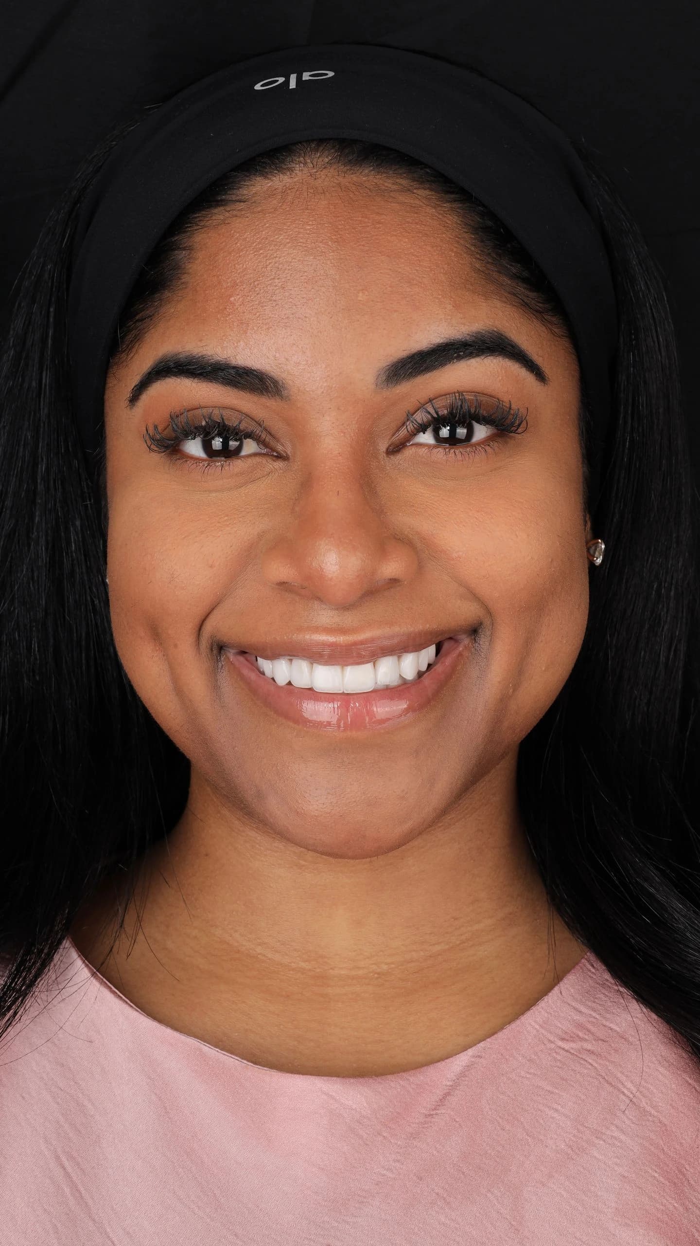 Patient smile result 29