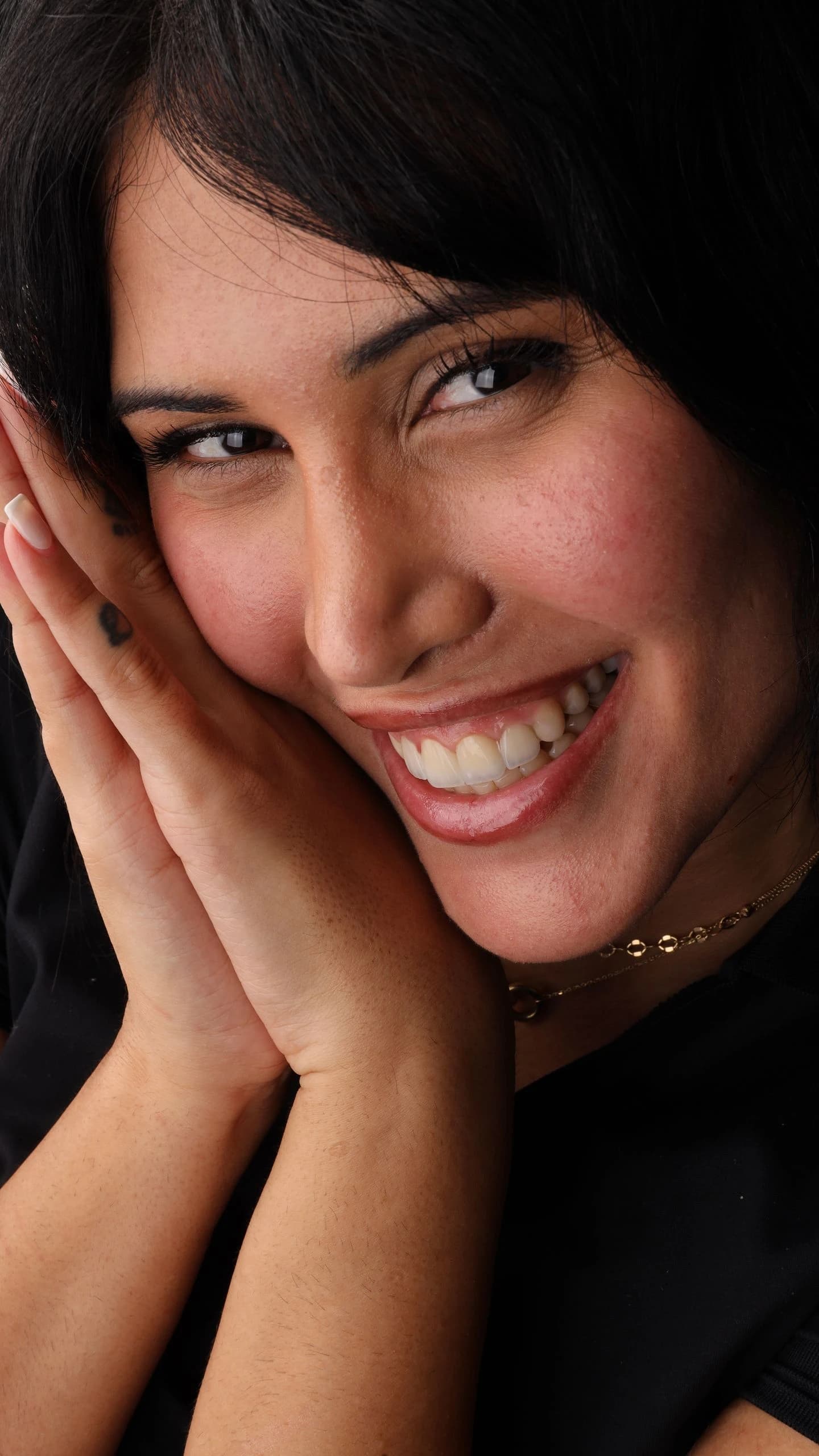 Patient smile result 28