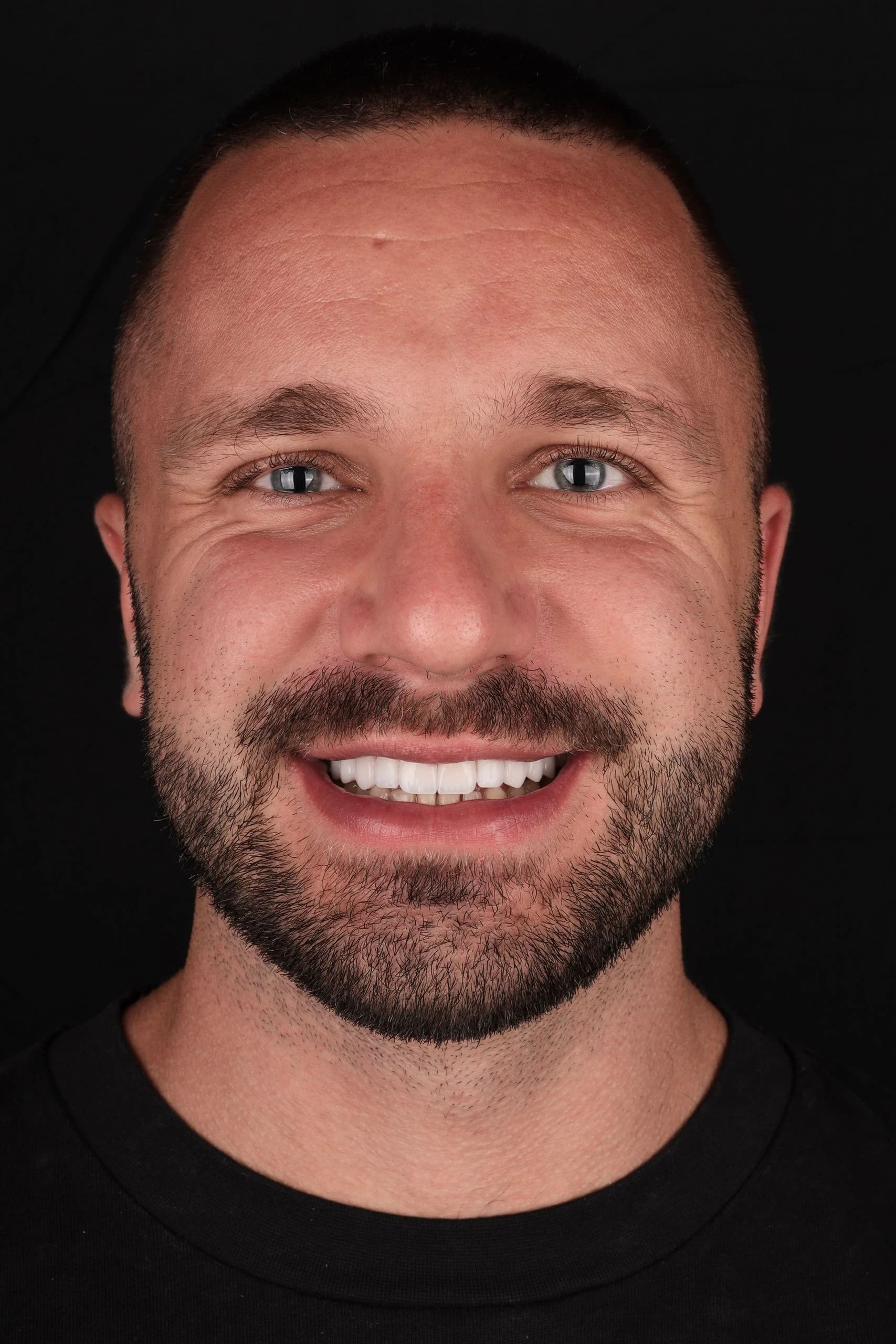 Patient smile result 7