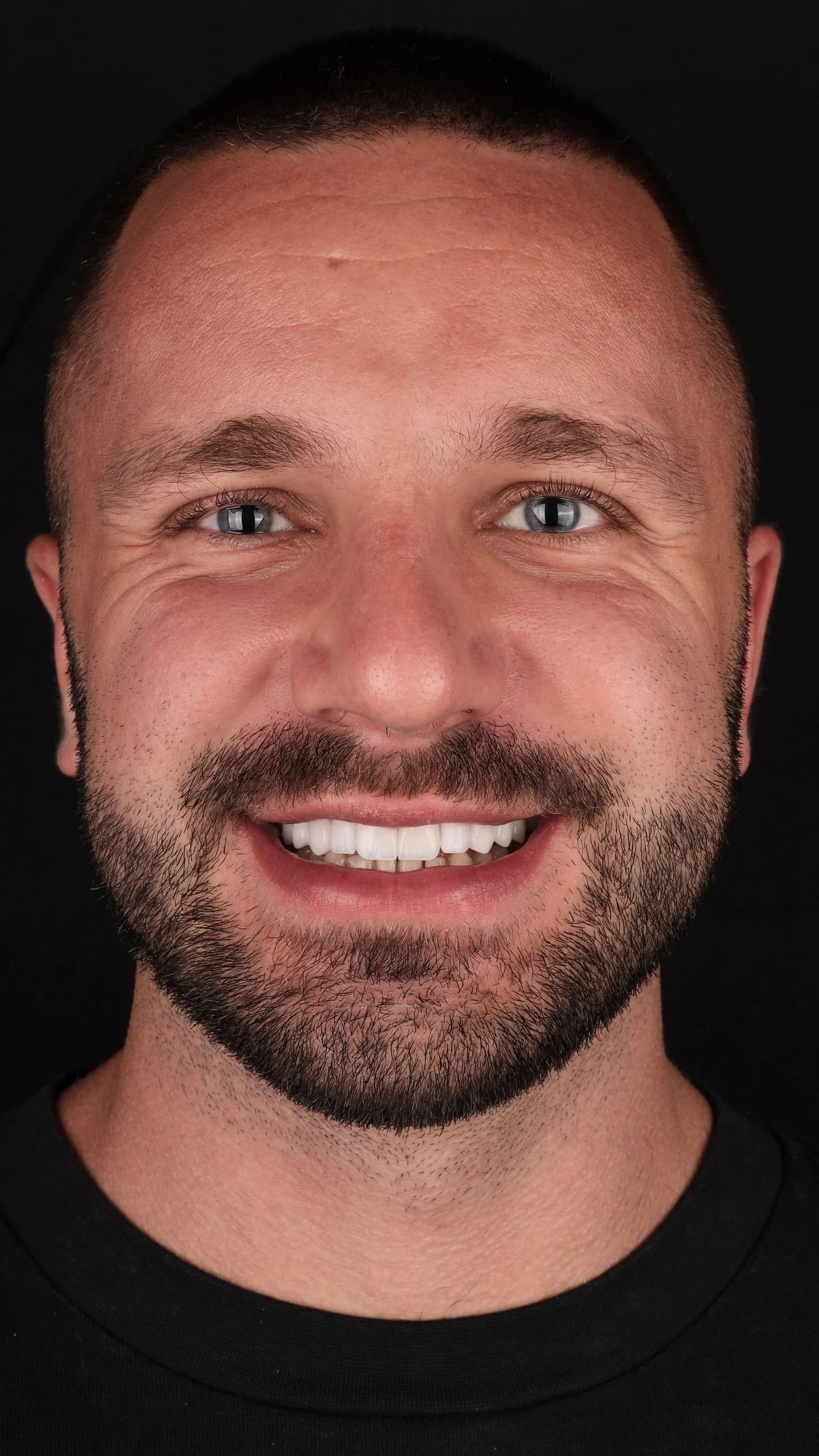 Patient smile result 27