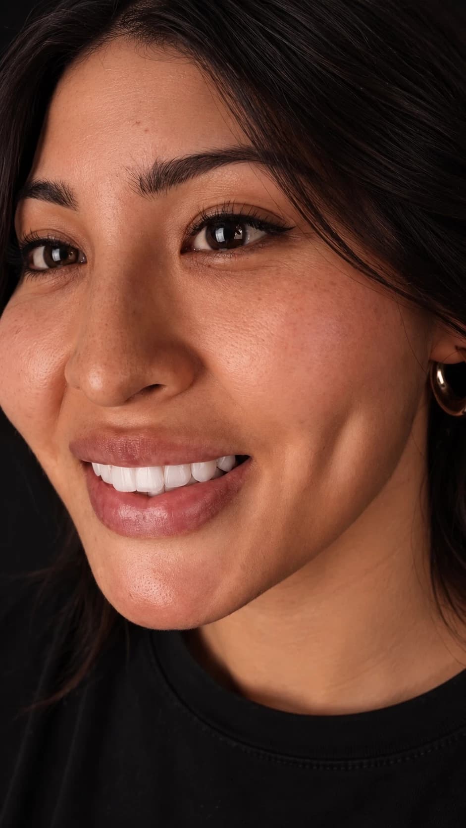 Patient smile result 1