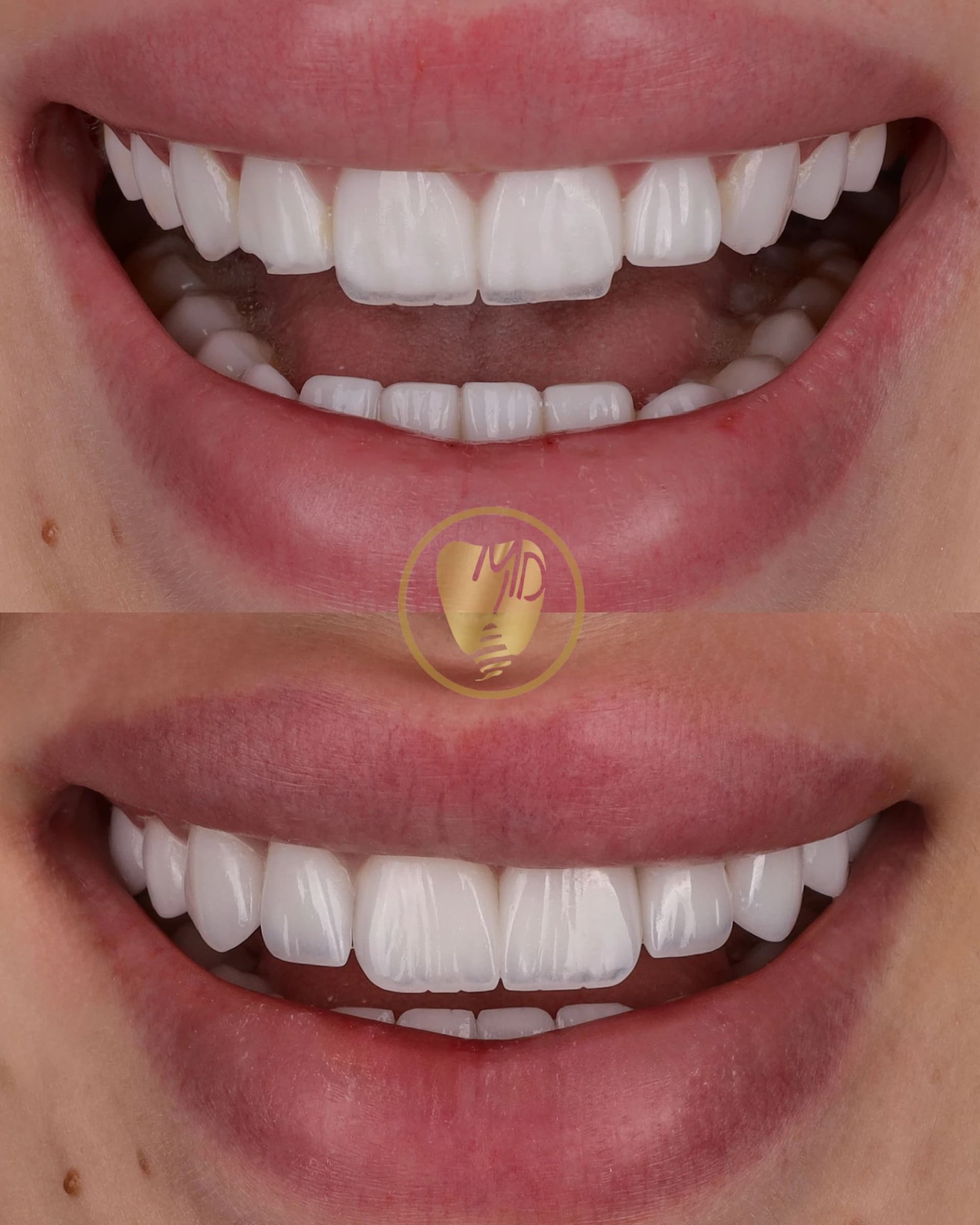 طبيب أسنان يشرح تكلفة ابتسامة هوليوود وخيارات العلاج لمريض في دبي