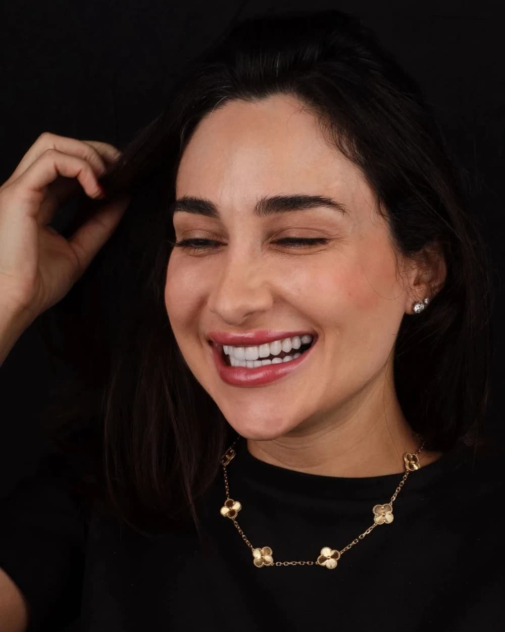 Patient smile result 2