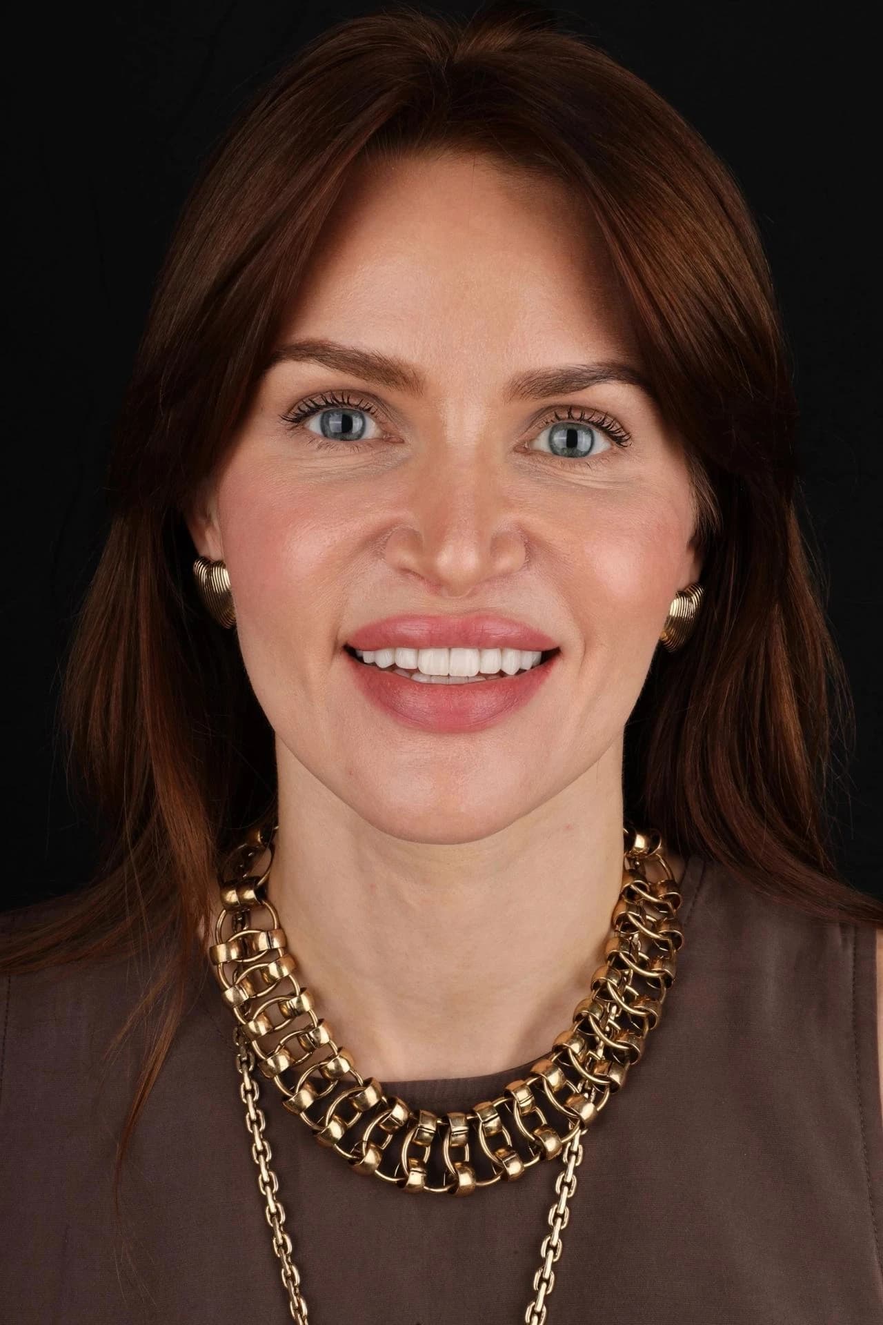 Patient smile result 34