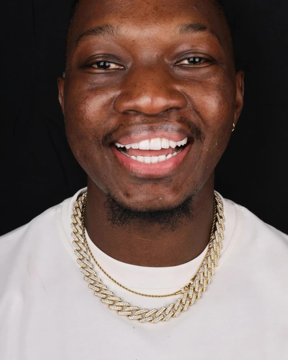 Patient smile result 9