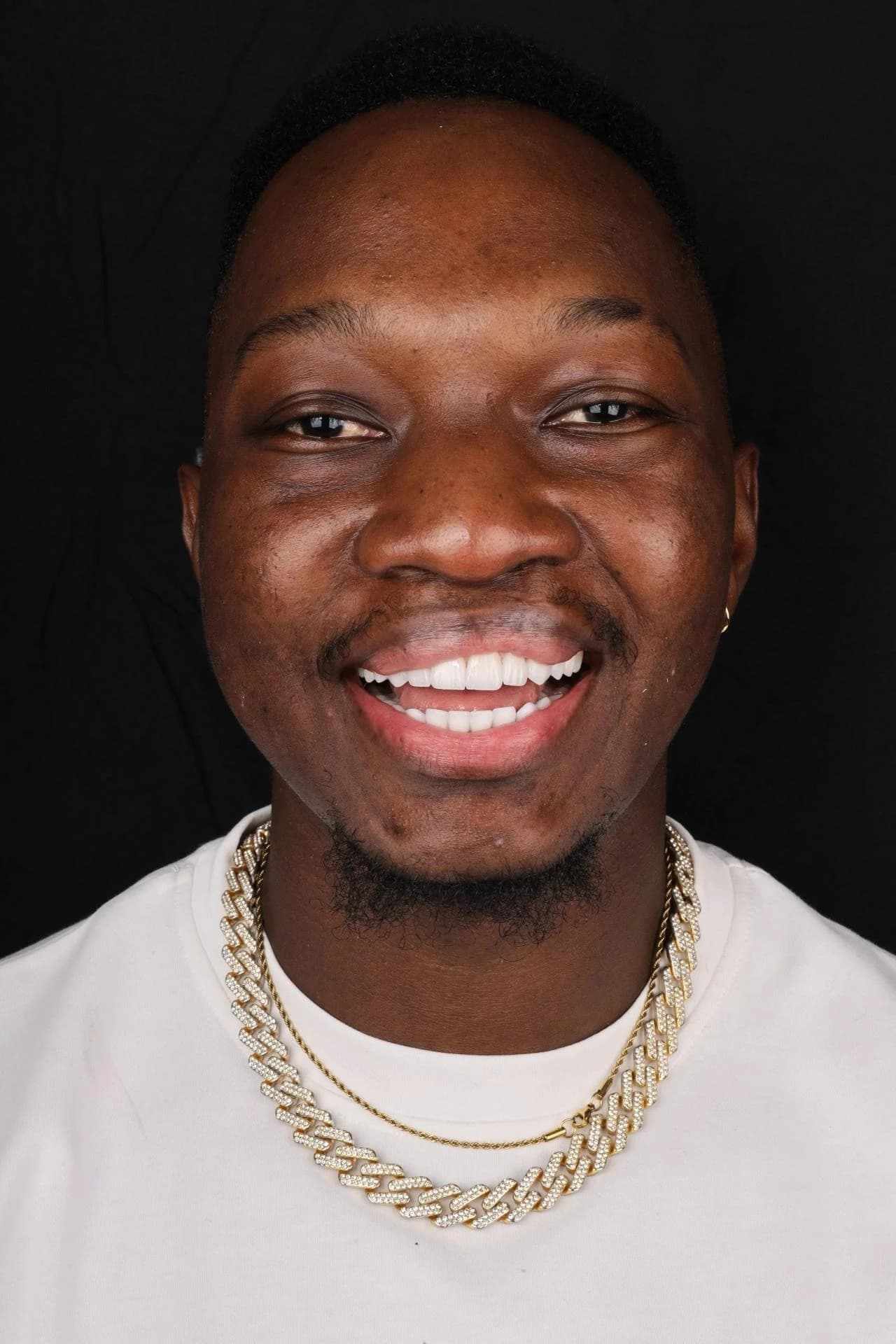 Patient smile result 33