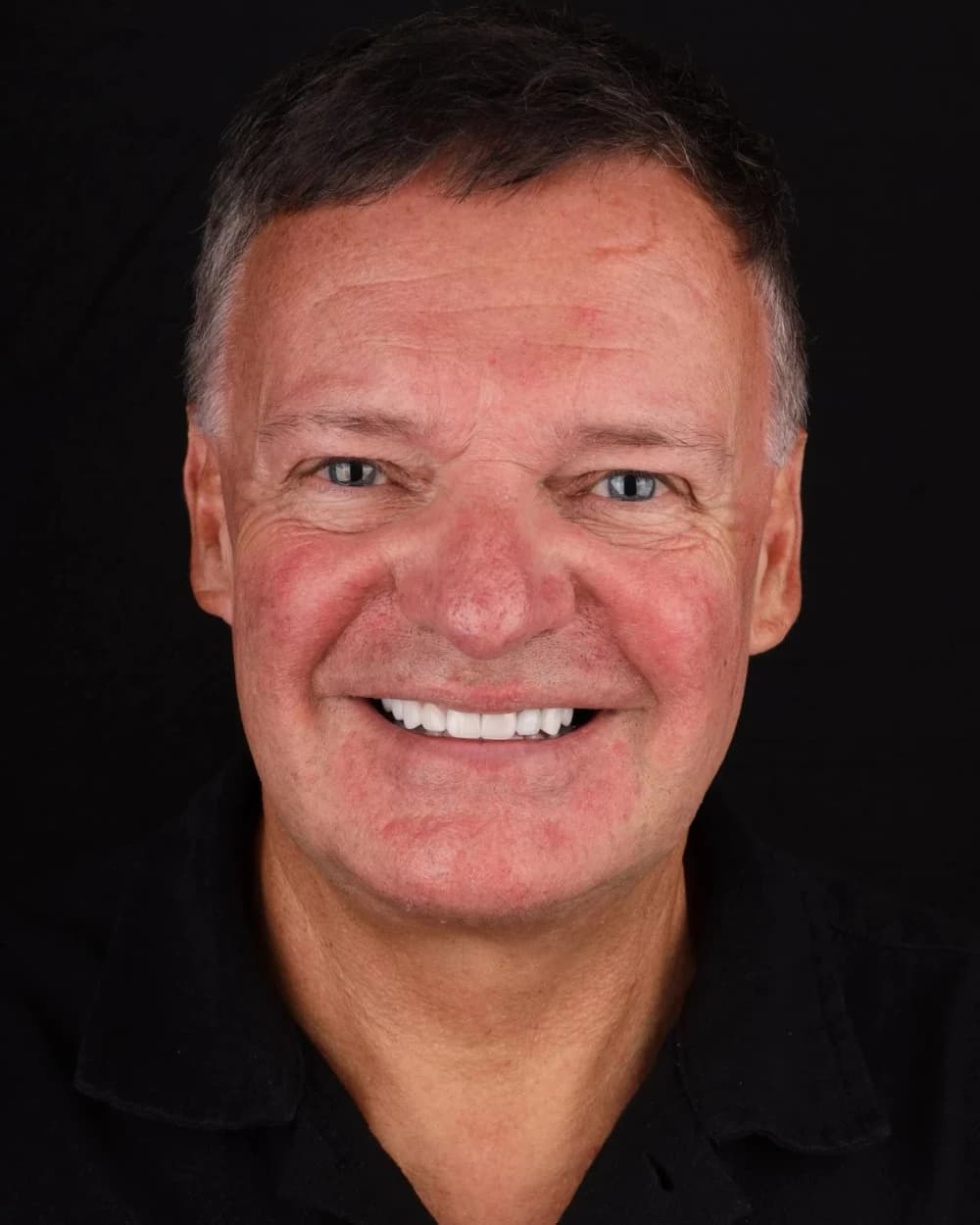 Patient smile result 1