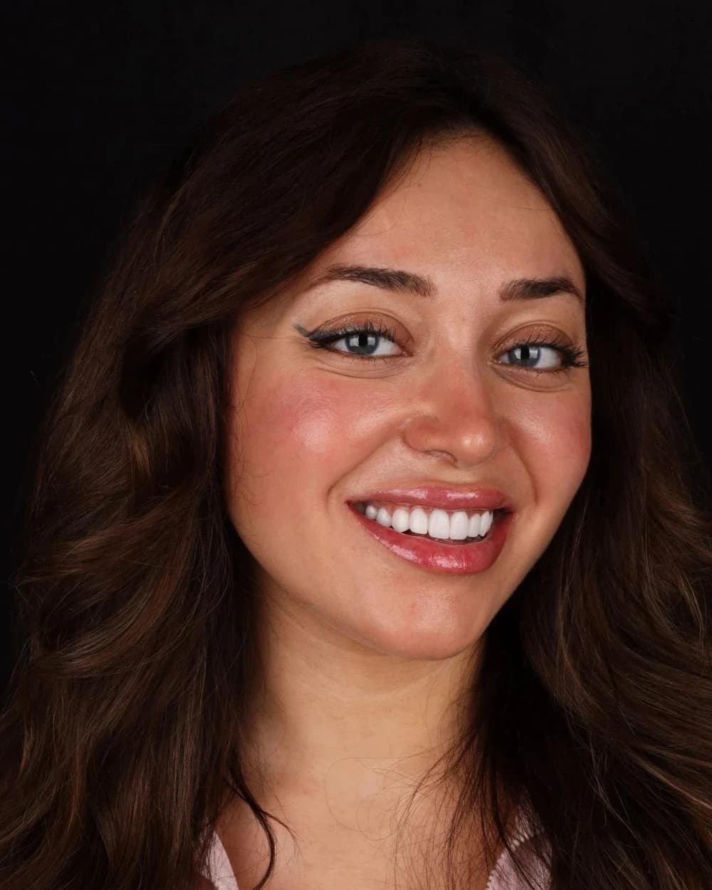 Patient smile result 5