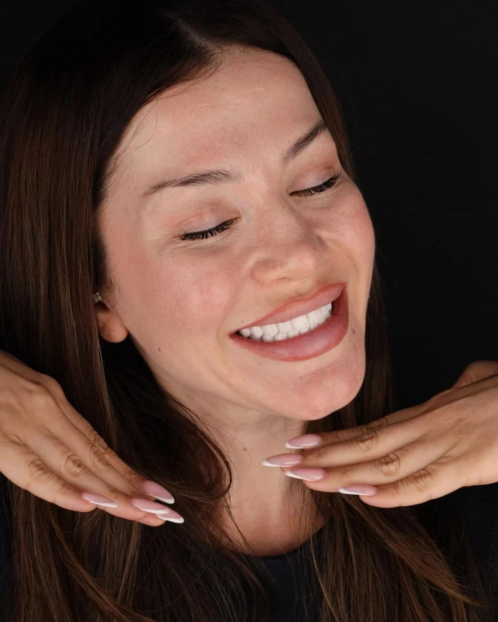 Patient smile result 6