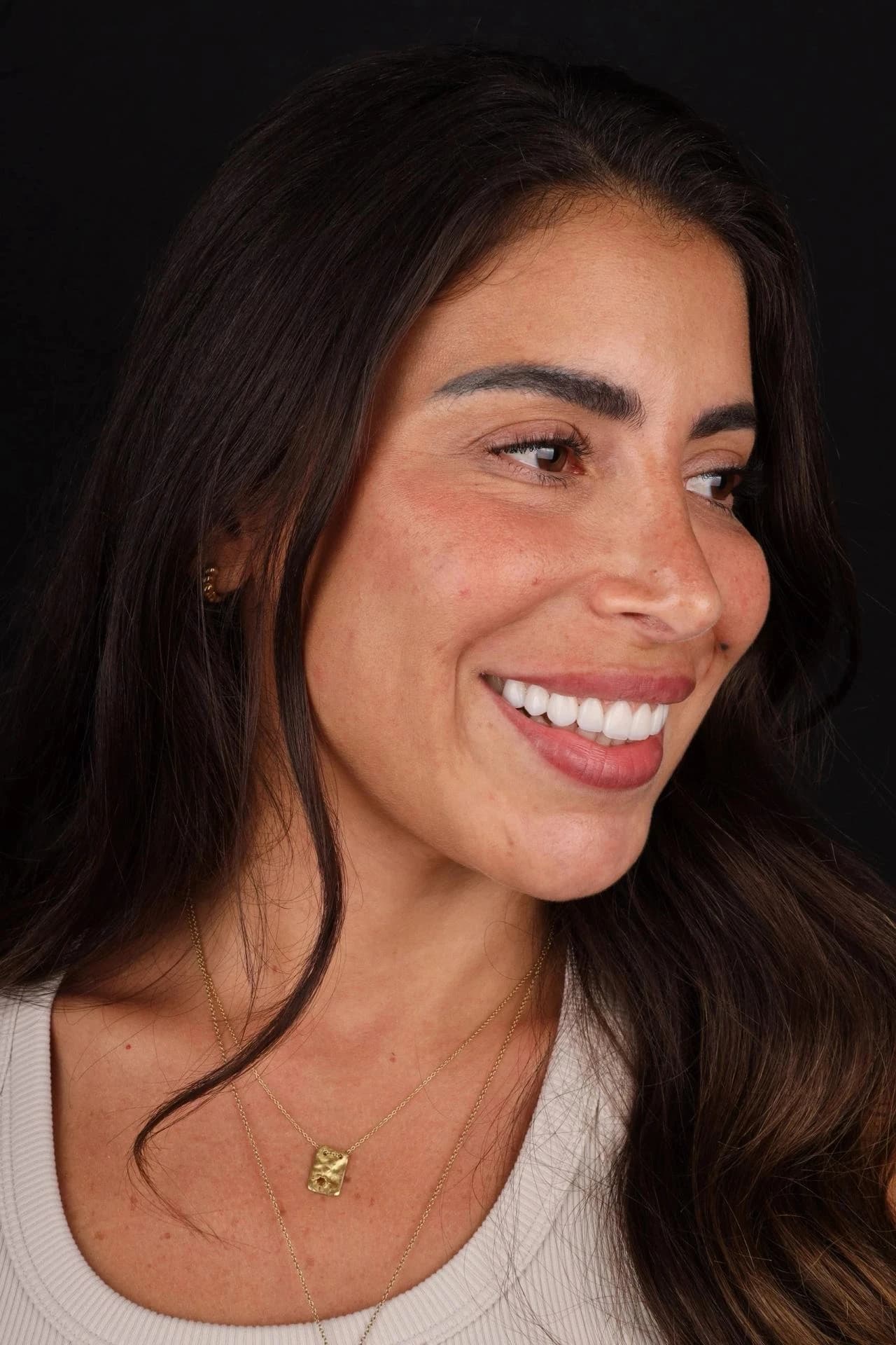 Patient smile result 31