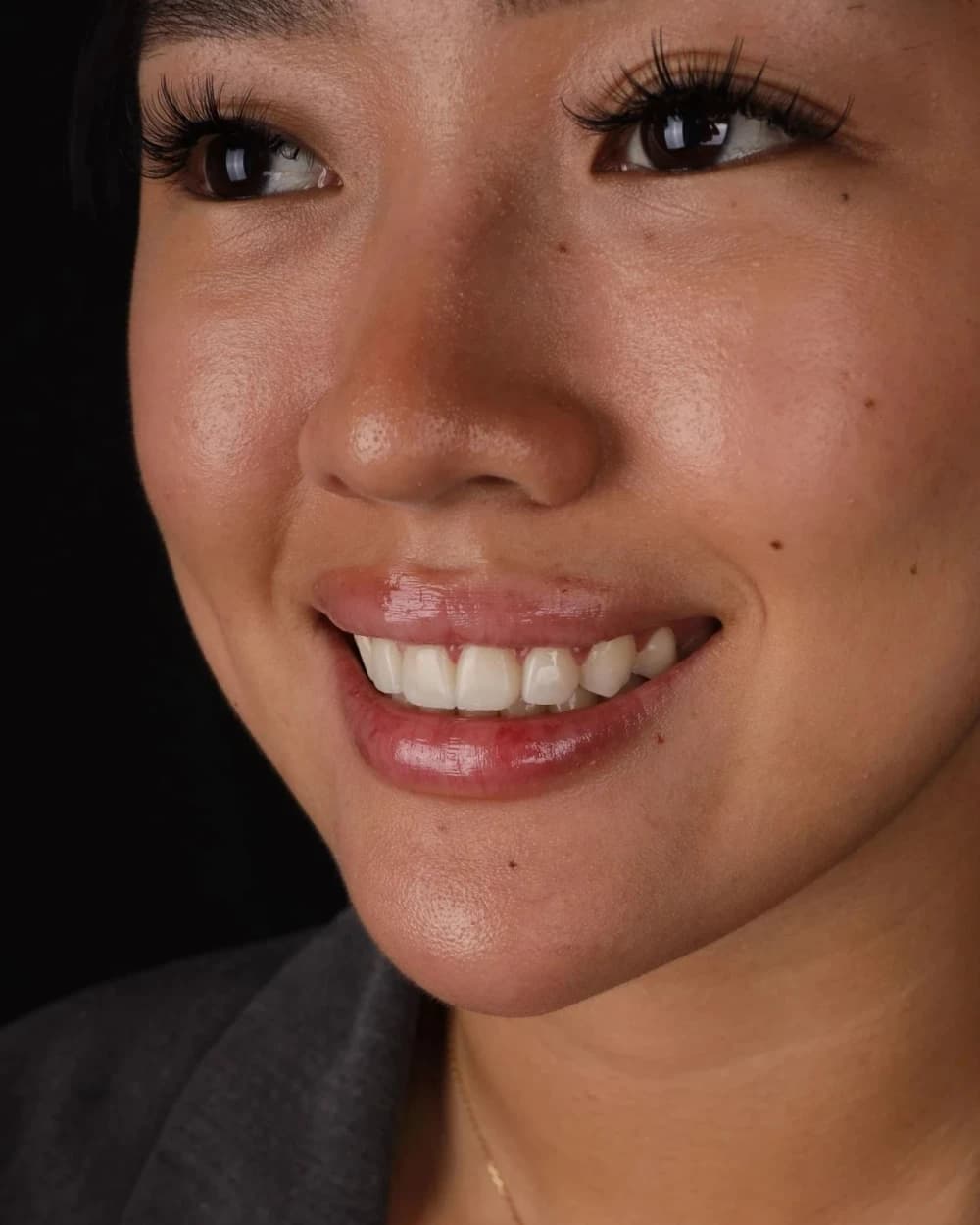 Patient smile result 12
