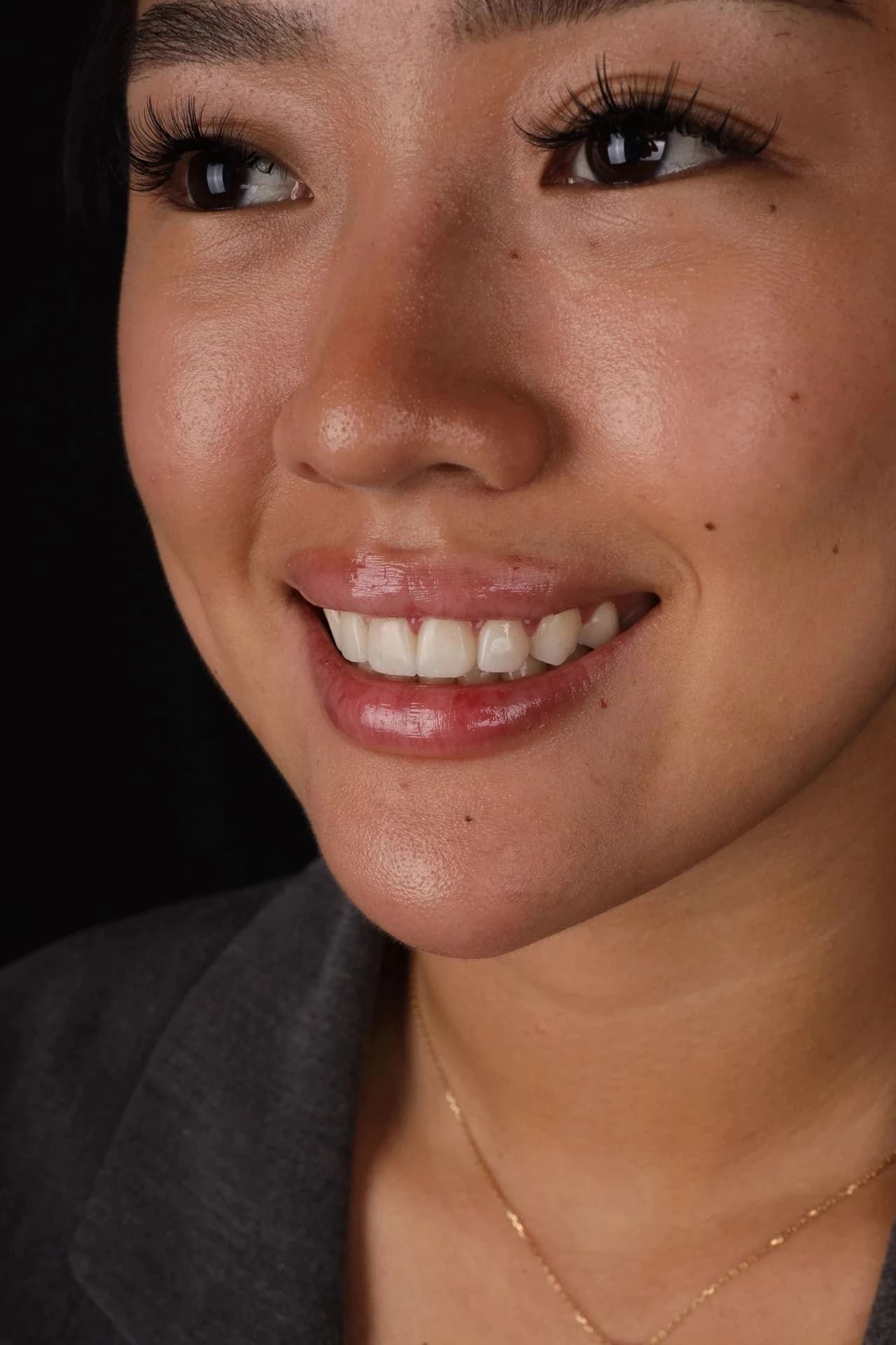 Patient smile result 36